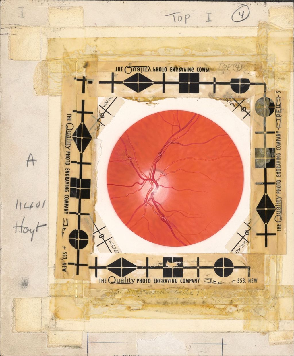 Miniature of Hypertension, Grade I, Artwork of veins, possibly fundus within eye
