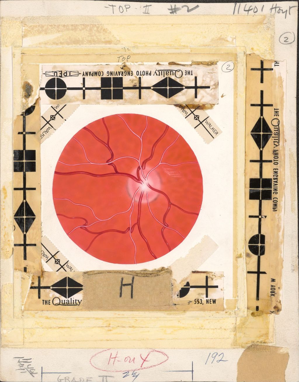 Miniature of Hypertension, Grade II, Artwork of veins, possibly fundus within eye