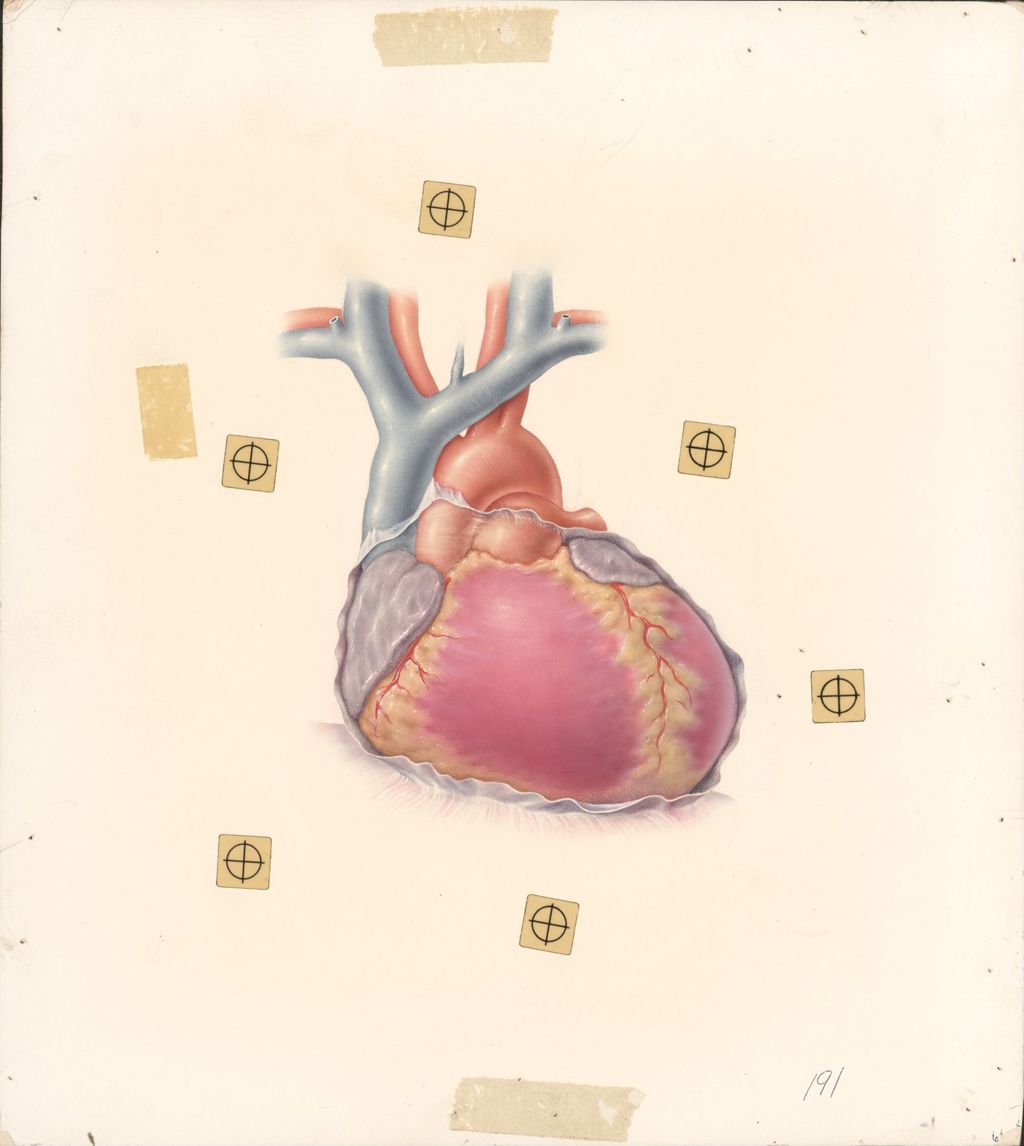 Miniature of Artwork of heart