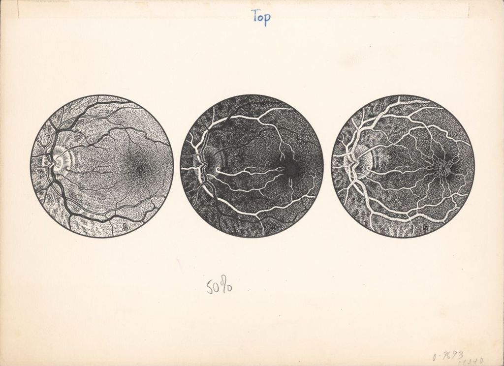Figure 1, Normal Fundus, The Normal Fundus After the Injection of Flourescein