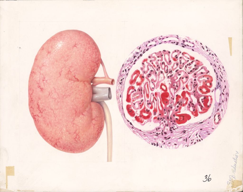 Miniature of Artwork of Kidney and unknown microscopic image