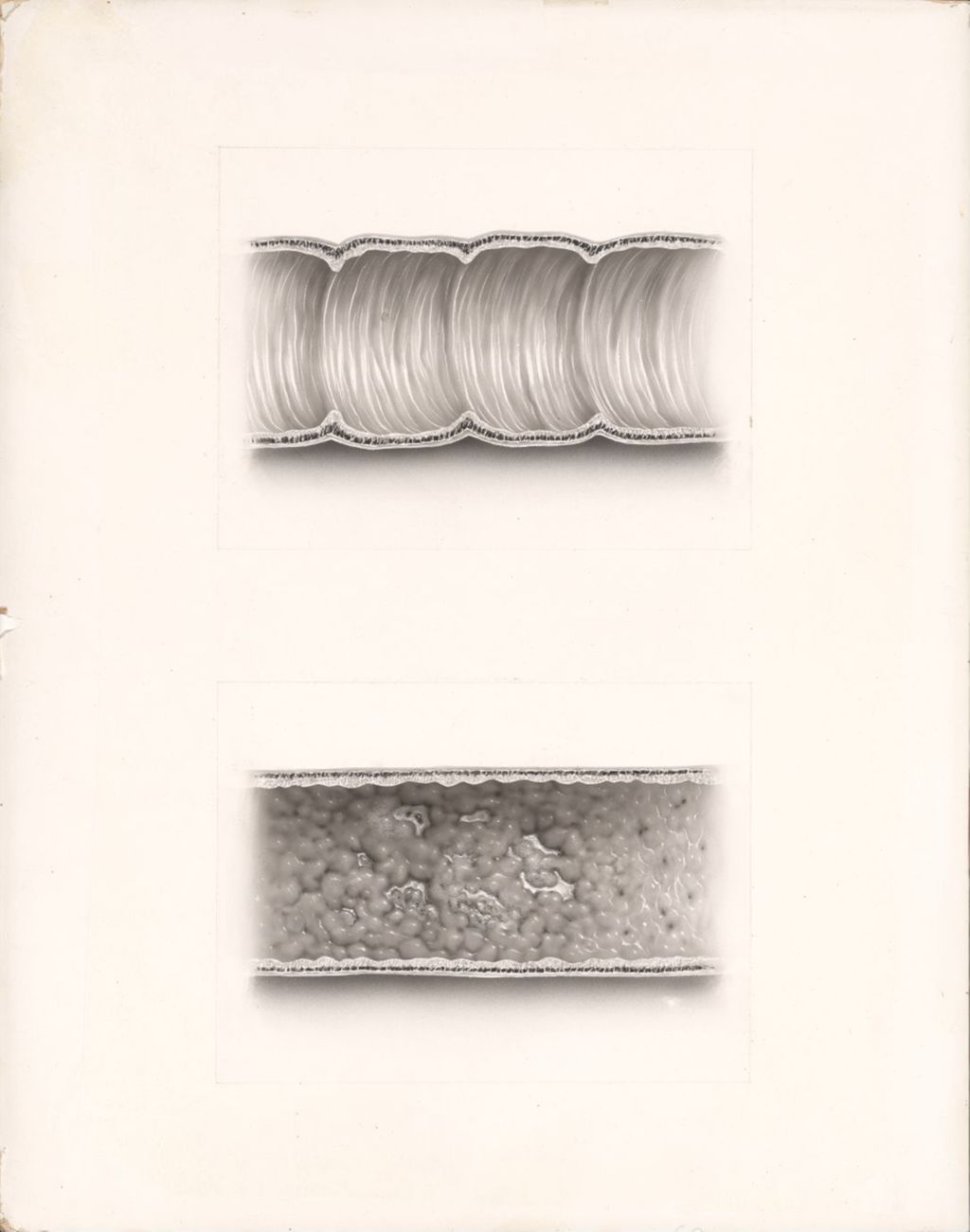 Miniature of Comprehensive Information Booklet, Sulfasuxidine Sulfathaladine, Neothaladine