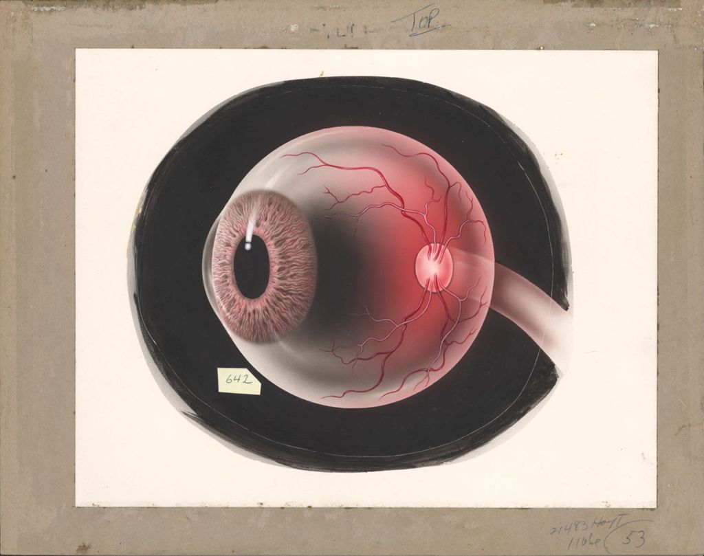 Miniature of Artwork of eyeball