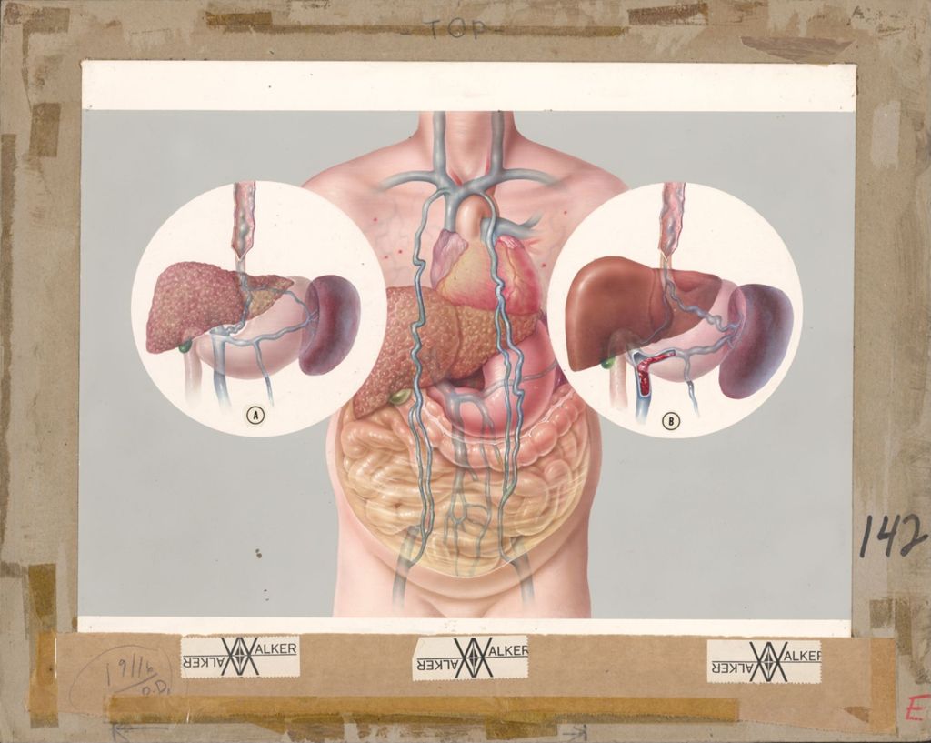 Miniature of Medical Profiles, Urocholine (MP-11), Plate II, The Parasympathetic Innervation of the Colon