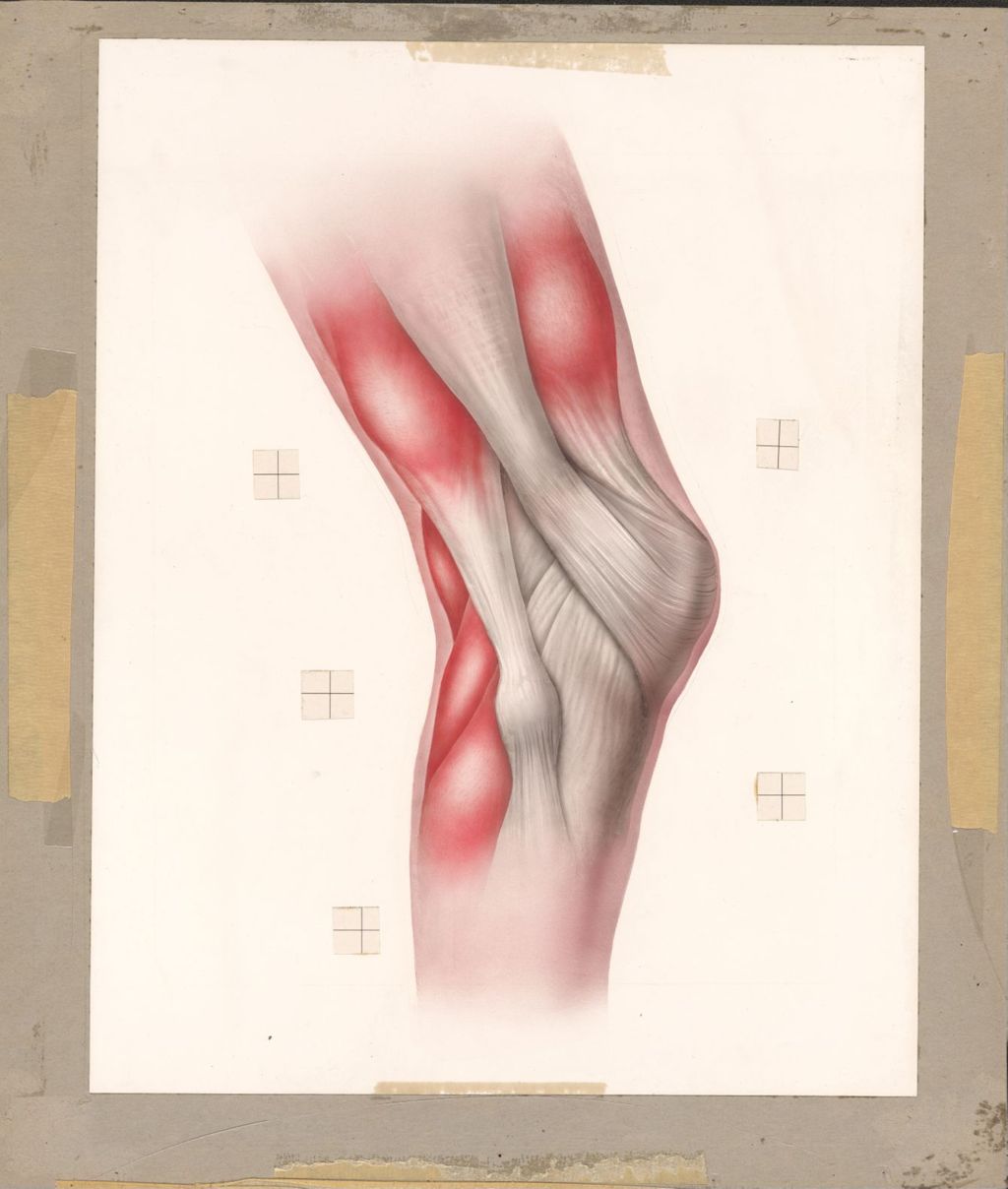 Miniature of Muscle Spasm Around Knee-Joint