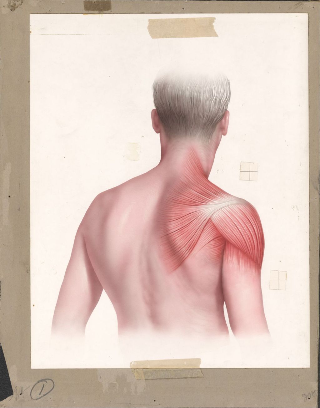 Miniature of Normal Relaxed Muscles of Shoulder