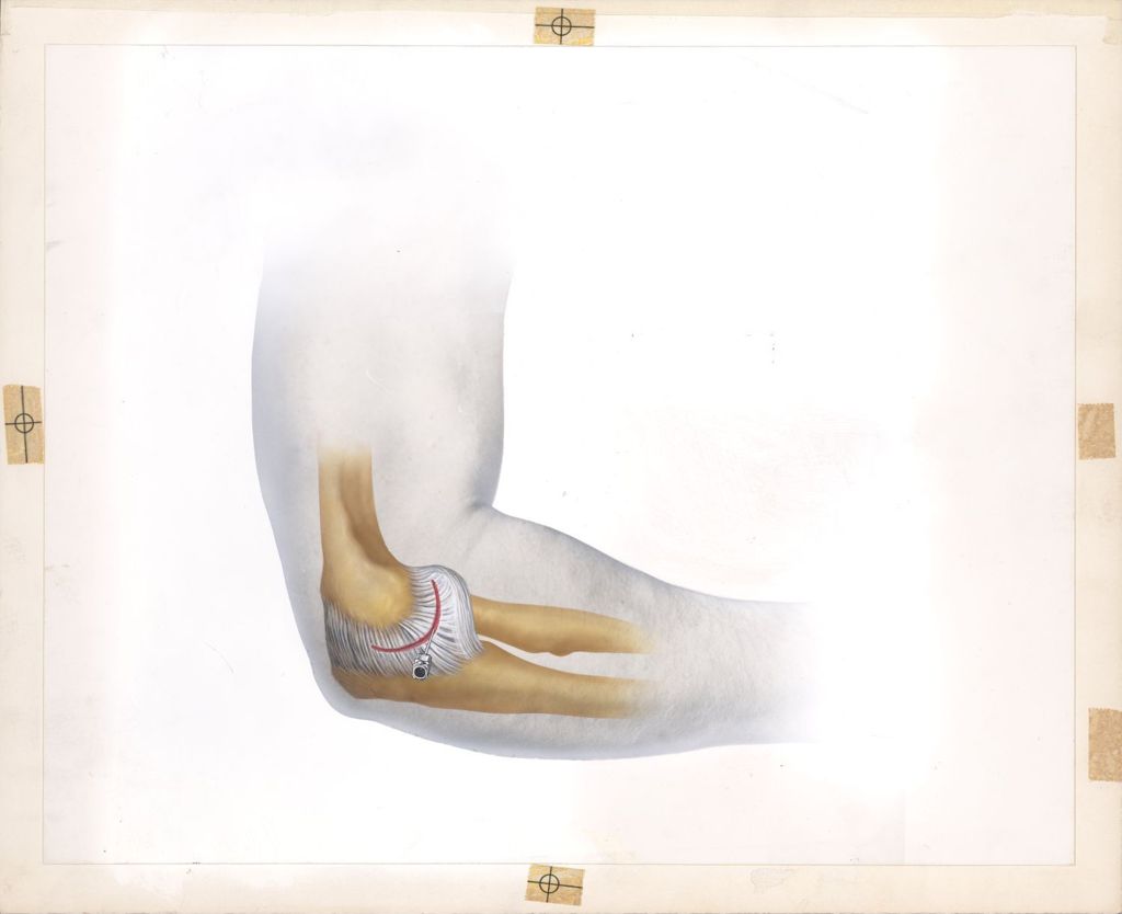 Miniature of The Elbow