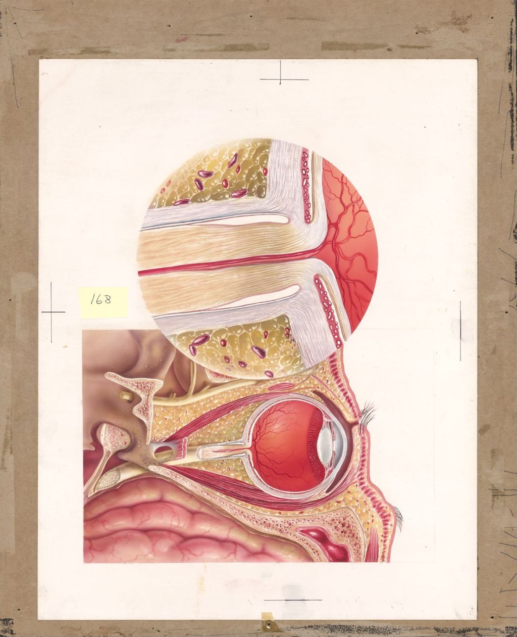 Miniature of Decadron, Artwork showing cross-section of eye with close up section on optical nerve
