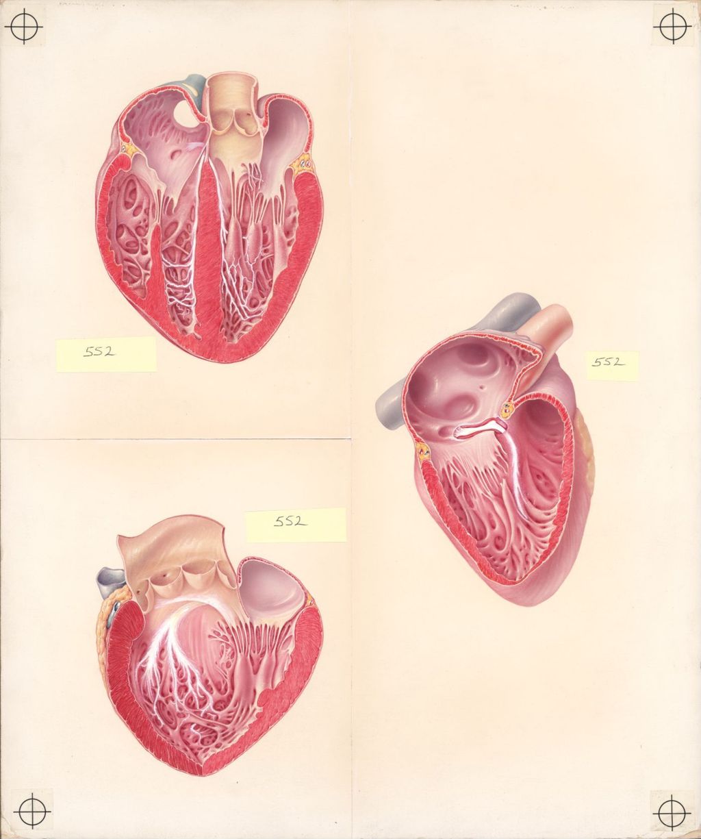 Miniature of Explanatory Atlas, the Autonomic Innervation of the Heart, Plate II, The Conduction System of the Heart