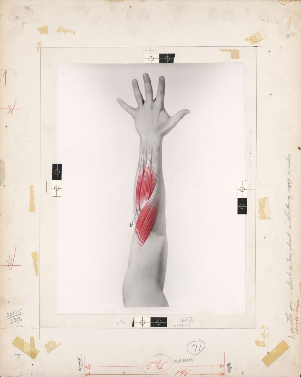 Miniature of Drawing on top of photograph of man's arm, showing needle insertion point in forearm muscle