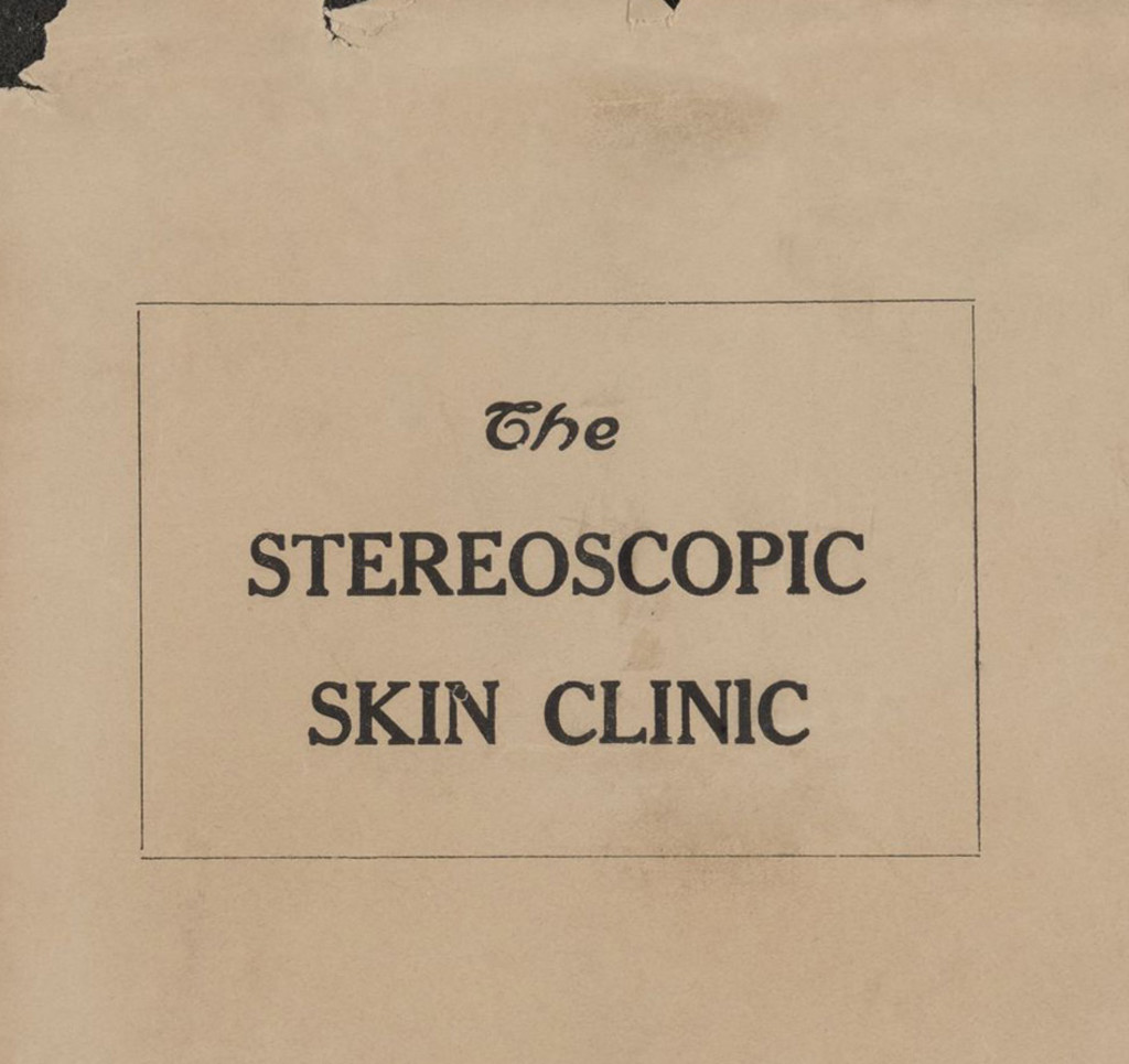 Miniature of "The stereoscopic skin clinic"